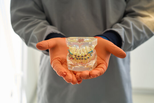 Modelo dental con aparatos ortop&eacute;dicos: concepto de atenci&oacute;n sanitaria y ortodoncia