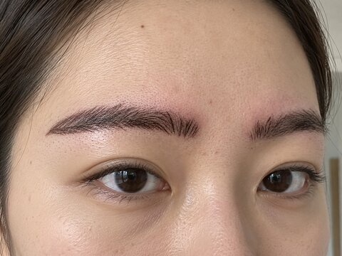 A close-up shot of a woman showing a botched eyebrow procedure to the camera, focusing on the failed "natural-look" (wild-style) and hairstroke-style brows.