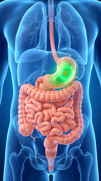 A detailed 3D medical illustration highlighting the human digestive tract, with a glowing green spot on the stomach indicating ache, ulcer, infection, or acid reflux, set against a transparent blue...