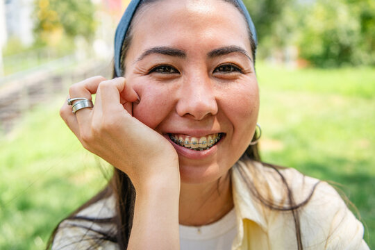 Smiling student with braces relaxing in a city park
