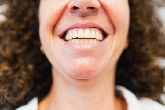 Woman smiling showing healthy white teeth