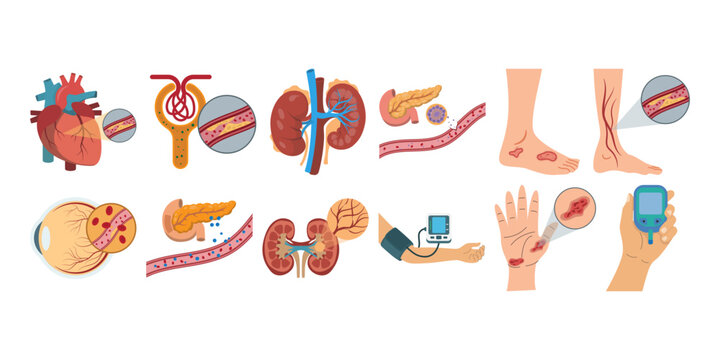 Illustration of World Diabetes Day designation