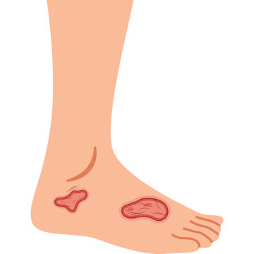 Illustration of World Diabetes Day designation
