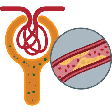 Illustration of World Diabetes Day designation