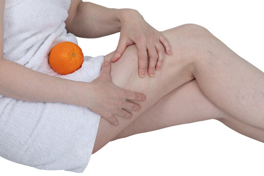 Woman examining skin texture on thigh with orange as cellulite metaphor. Body care and anti cellulite treatment concept. Skincare routine and fat reduction visualization for health