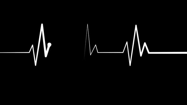 Digital Heartbeat Wave Animation with Medical ECG Signal Display