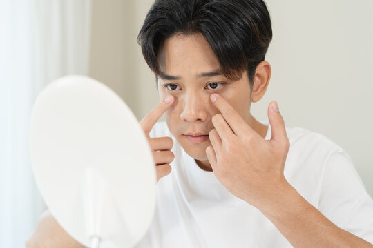 Asian men worry about acne on their faces when looking in the mirror
