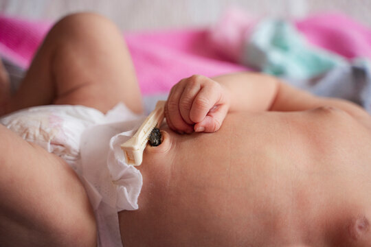 Newborn's umbilical cord clamp healing process