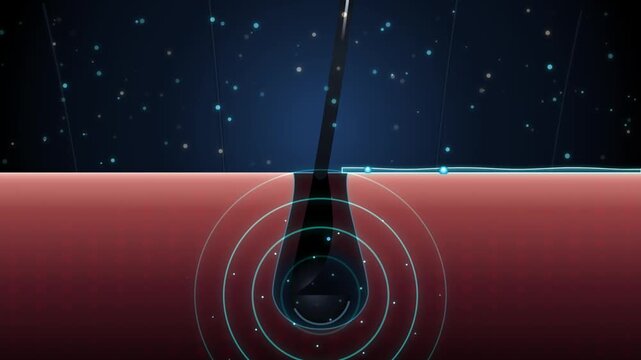 Conceptual illustration of laser hair removal treatment targeting the hair follicle beneath the skin surface with light energy pulses