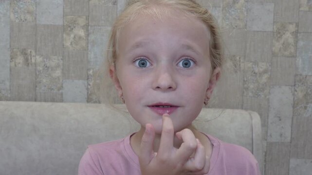 Little girl having toothache after eating sweet lollipop, Little girl hurt her moving tooth while eating candy on a stick