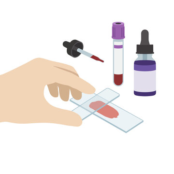 Hand performing medical blood sample analysis on glass slide