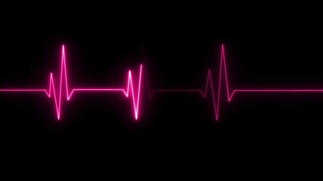 Neon pink ekg heartbeat monitor loop, medical pulse line animation for healthcare and science technology projects