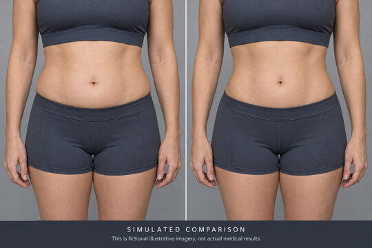 Simulated Body Transformation Comparison Showing Waist Change