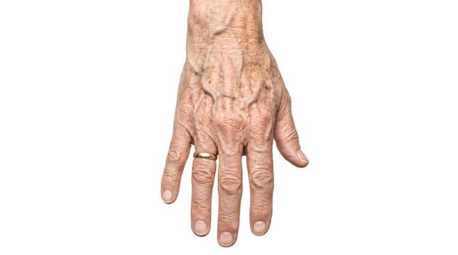 Aged hand with visible veins and a simple gold wedding band showcasing wrinkles, signs of maturity, and timeless human elegance on transparent background