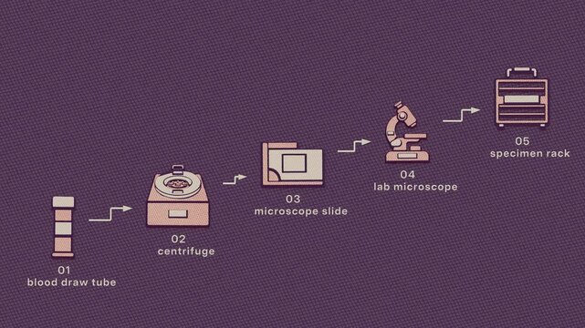 The specimen pathway advances stepwise through sample collection, centrifugation, slide preparation and microscopic examination to support diagnosis. Flat 3D style with cross-hatching; objects