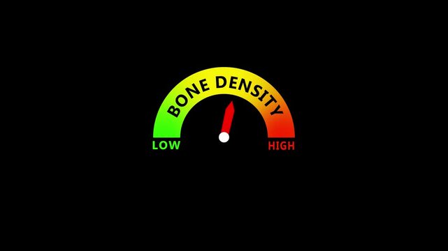 Bone Density Level Medical Gauge Showing Low to Normal and High Bone Strength for Osteoporosis Risk, Fitness and Health Assessment