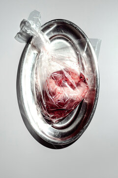 A heart in Plastic Bag on Metal Tray During Medical Procedure