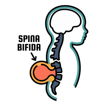 Spina Bifida Neural Tube MRI Icon for Pediatric Neurology
