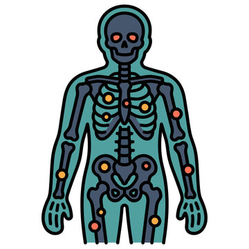 Bone Metastasis Gamma Camera Scan Icon for Oncology
