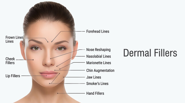 The areas for rejuvenation cosmetological injections