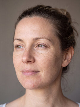 Sun Damage and Signs of Skin Aging