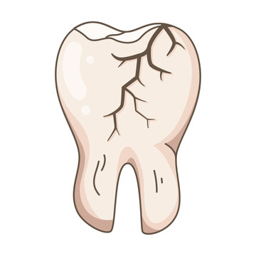 Hand-drawn illustration depicting a cracked and damaged molar tooth