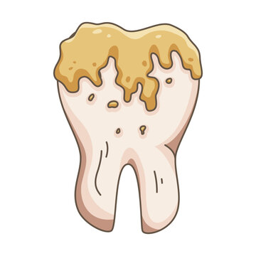 cartoon  illustration of an unhealthy molar tooth covered in yellow plaque and showing signs of decay, perfect for dental health and hygiene education.