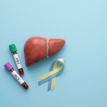Medical Concept Of Hepatitis B And C Diagnosis With Liver Model And Ribbons