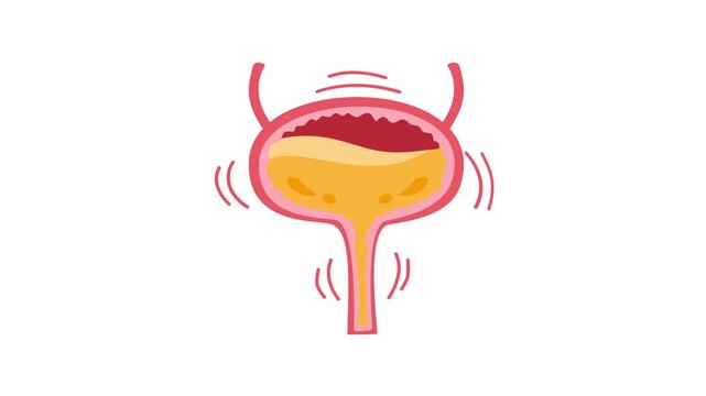 bladder incontinence urge organ anatomy illustration