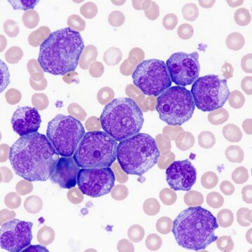 Microscopic View Of Leukemia Cells Showing Abnormal Blood Morphology