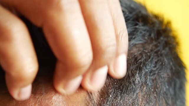 Close up video showing a hand scratching dandruff from dark hair on a yellow background