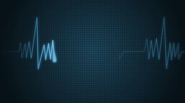 Animated Heartbeat Line Wave Signal with Clear Pulse and Minimalist Medical Visualization