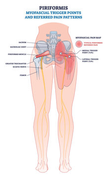 Piriformis trigger points and referred pain mapped on the posterior pelvis, showing piriformis muscle, sciatic nerve, and hip region zones. Outline diagram