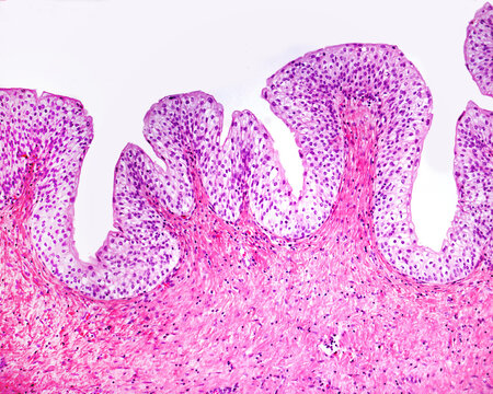 Urinary bladder mucosa