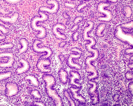 Human endometrium. Late proliferative phase