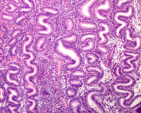 Human endometrium. Late proliferative phase