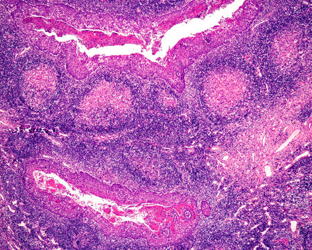 Human palatine tonsil