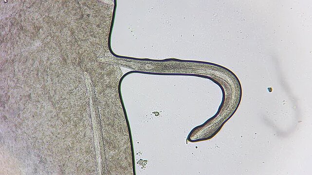 Active and immobile nematode roundworms side by side under 100x brightfield microscopy magnification