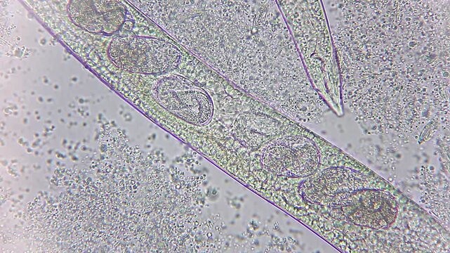 Nematode roundworm with active moving eggs inside body under 400x brightfield microscopy
