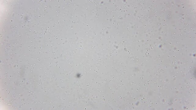 Massive colony of active bacteria swimming in liquid medium under 400x brightfield microscopy