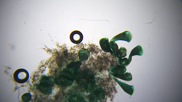 Colony of trumpet-shaped Stentor ciliates attached to substrate under 40x brightfield microscopy