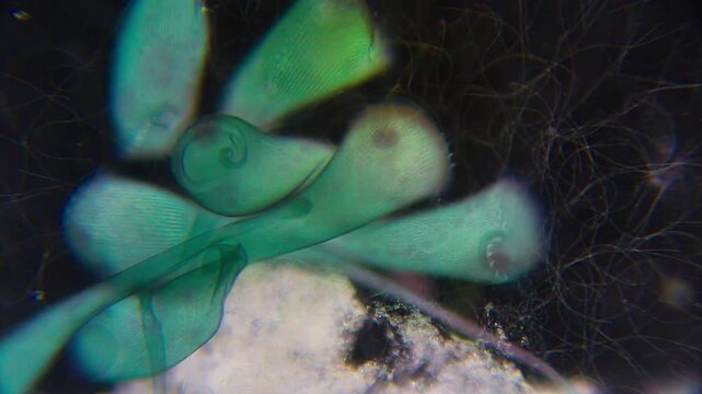 Colony of Stentor coeruleus ciliates attached to substrate feeding on bacteria under 100x darkfield microscopy