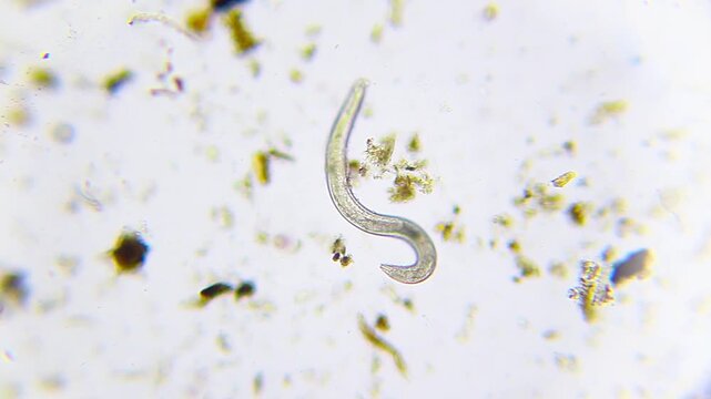 Active nematode roundworm wriggling among organic detritus under 100x brightfield microscopy magnification