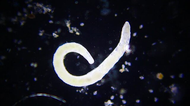 Nematode roundworm wriggling in liquid medium under 40x magnification darkfield microscopy