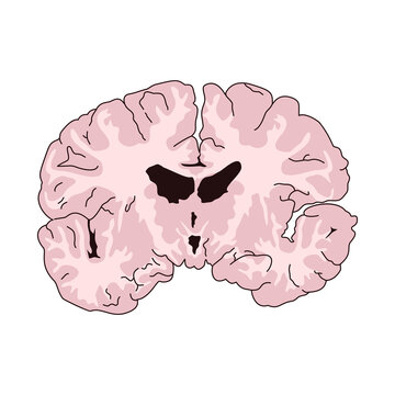 Coronal Section of Human Brain Medical Vector Illustration