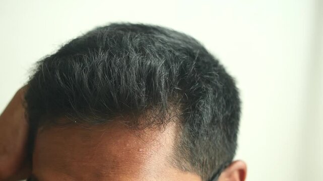 Close up of man running hand through short dark hair with hints of grey
