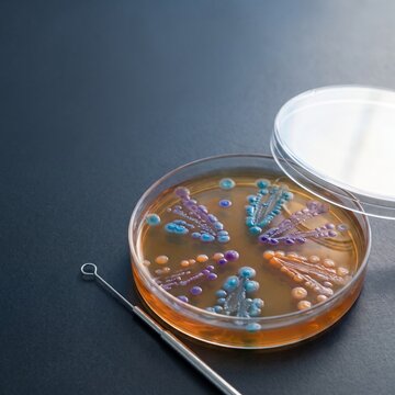 Microbiology agar petri dish with colorful microbial colonies and inoculation loop for biotech research