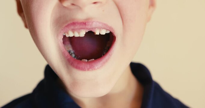 Child showing a missing front baby tooth