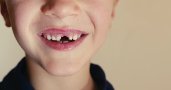 Close-up of a young boy smiling showing his missing tooth