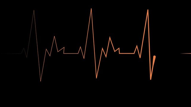 Heartbeat line pulse rhythm and sharp peaks simple medical concept for health animation